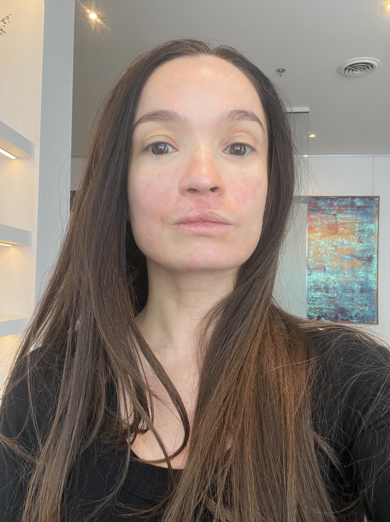 Spa - facial - dermo-esthétique - Peeling